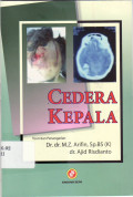 Cedera kepala