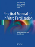 Practical Manual of In Vitro FertilizationAdvanced Methods and Novel Devices /