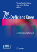 The ACL-Deficient KneeA Problem Solving Approach /