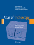 Atlas of TrichoscopyDermoscopy in Hair and Scalp Disease /