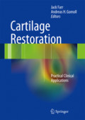 Cartilage RestorationPractical Clinical Applications /