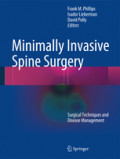 Minimally Invasive Spine SurgerySurgical Techniques and Disease Management /