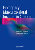 Emergency Musculoskeletal Imaging in Children