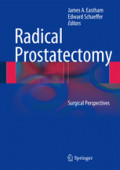 Radical ProstatectomySurgical Perspectives /