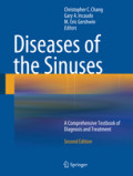 Diseases of the SinusesA Comprehensive Textbook of Diagnosis and Treatment /