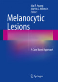 Melanocytic LesionsA Case Based Approach /