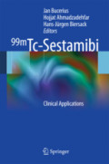 99mTc-SestamibiClinical Applications /