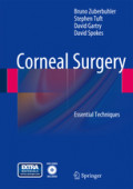 Corneal SurgeryEssential Techniques /