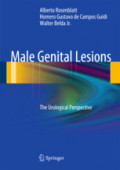 Male Genital LesionsThe Urological Perspective /