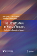 The Ultrastructure of Human TumoursApplications in Diagnosis and Research /