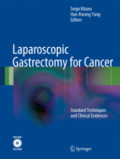 Laparoscopic Gastrectomy for CancerStandard Techniques and Clinical Evidences /